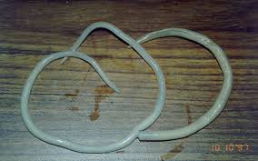 File:Ascaris lumbricoides adult worms ...